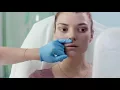 Lip Injections at Cienega Med Spa