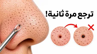 ليش الرؤوس السوداء ما تروح مهما شلتيها؟؟