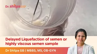 Delayed Liquefaction of semen or highly viscous semen sample Dr Shilpa GB