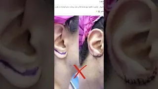 هل صحيح شحمة الأذن تباع    مليون دولار     دندنها