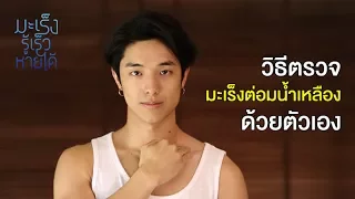  ทำไมต่อมน้ำเหลืองบางตำแหน่งจึงตรวจไม่ได้ด้วยตนเอง 