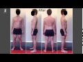 Rolfing 10 Series Before After