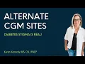Alternative Continous Glucose Monitor CGM Sites for FreeStyle Libre and Dexcom