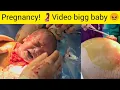Download Lagu Pregnancy delivery 🤰 bigg baby 😖 #pregnancy #video #baby