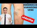 Download Lagu Namažite ovo i UKLONITE VARIKOZNE VENE - RECEPT!