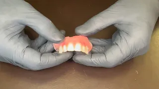 i didnt like my prosthesis how to avoid it