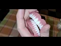 I went to Affordable Dentures and Implants My permanents The bottoms