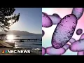 Download Lagu California resident tests positive for bubonic plague