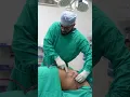 Download Lagu Gynecomastia Surgery | Gynecomastia Surgery cost | #shortvideo #shots