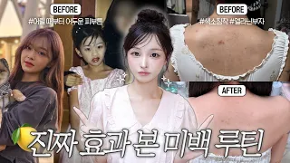 까맣게 컸어..?🥹 멜라닌&색소침착 부자의 ”진짜“ 효과 본 전신 미백 루틴🍋✨ | 트러블 색소침착, 겨드랑이, 탄 피부, 치아 미백까지🦷