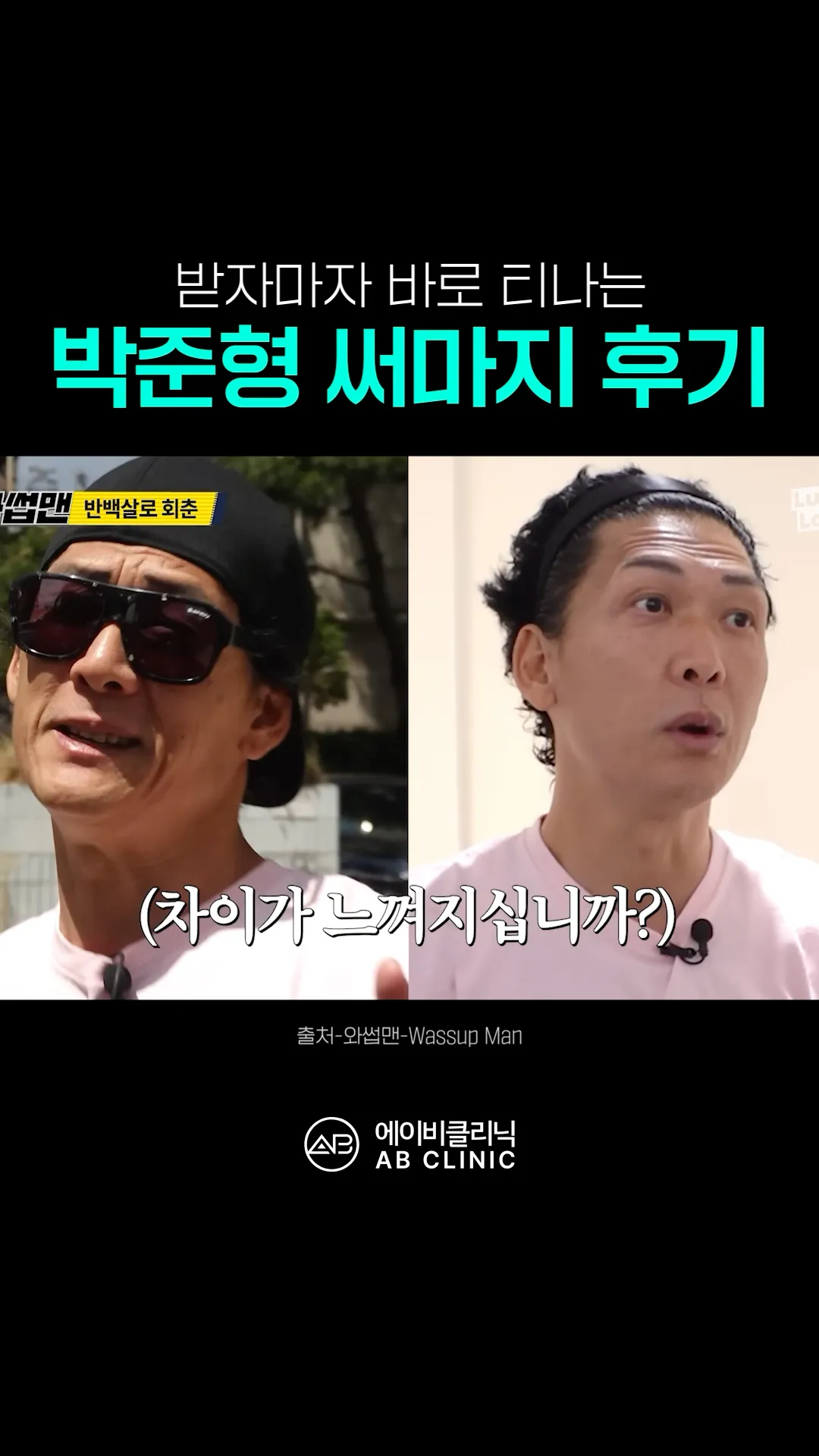 박준형 써마지 후기