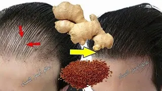 كنز رباني عظيم أقسم بالله ينبت الشعر حتى لو كان صلع ويوقف التساقط في الحين يملأ الفراغات ويكثف شعر 