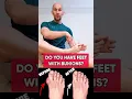 How to Fix Bunions Fast #bunions #physiotherapy