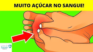 7 SINAIS QUE VOCÊ ESTÁ COMENDO MUITO AÇÚCAR (O 7º NINGUÉM PERCEBE)