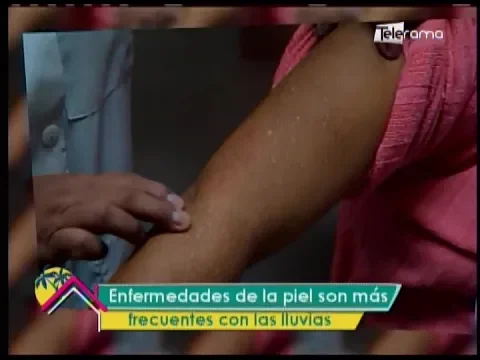 Dr. en Casa: Enfermedades de la piel son más frecuentes con las lluvias