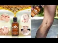 Lymphatic Draining Ginger Oil Review 2020 - belly drainage ginger oil