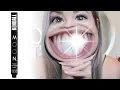Kendall Jenner MOON Oral Care Teeth Whitening Pen REVIEW