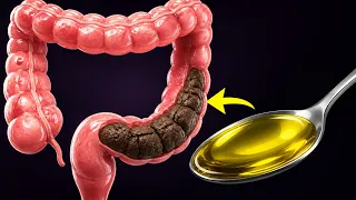CONSTIPATION: vide naturellement et rapidement ton intestin avec ces 5 recettes