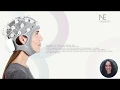CNN MRI segmentation for fast and robust optimization of the human brain tES