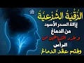 Download Lagu الرقية الشرعية لإخراج السحر من الدماغ وإخراج الشياطين منه وفتح عقد الدماغ