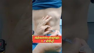 تعلم إعطاء حقنه تحت الجلد في المنزل بطريقة احترافية 
