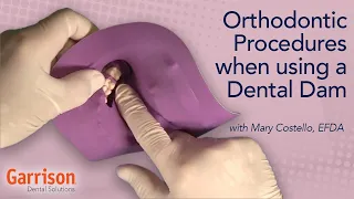 Orthodontic Procedures When Using a Dental Dam Mary Costello EFDA