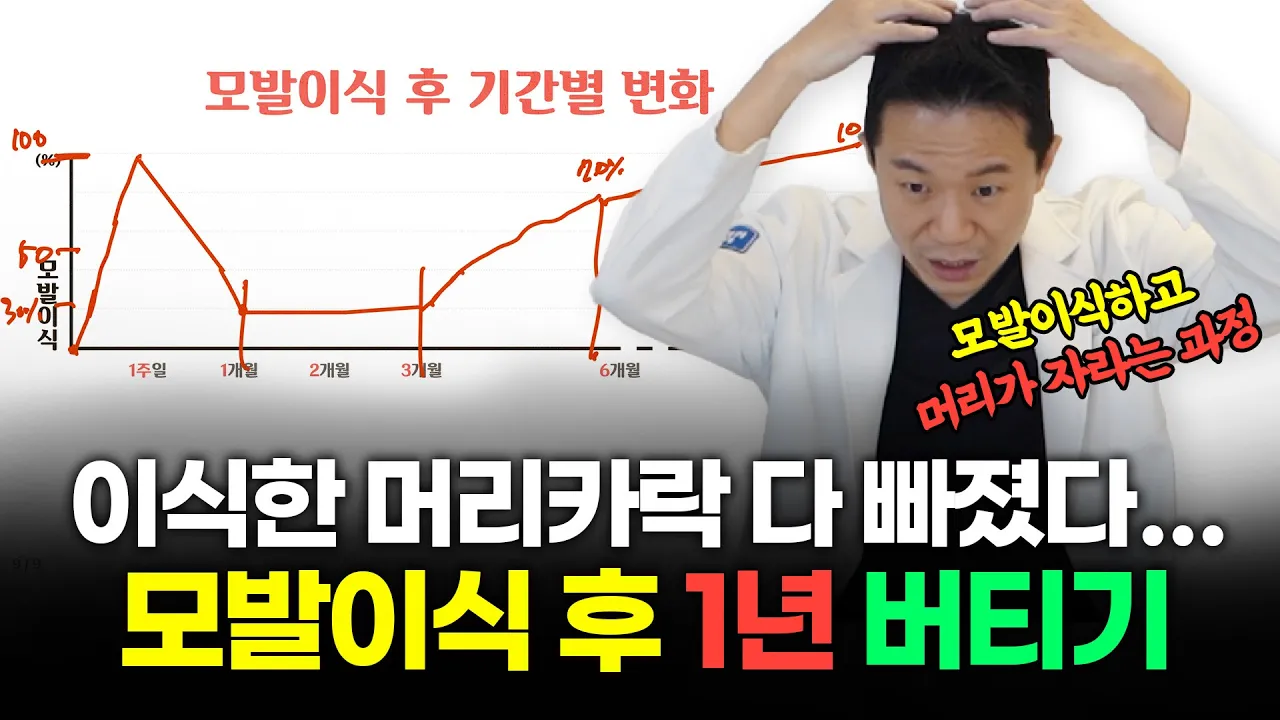 모발이식했는데 이식한 모발이 다 빠졌다... 모발이식 후 1년은 이 영상 보고 버티세요