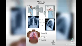 الفحوصات اللازمة التي يمكن ان يطلبها طبيبك قبل العملية 