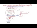 What is Queue Data Structure Insertion and Deletion in queue data structure