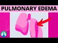 Pulmonary Edema Medical Definition Quick Explainer