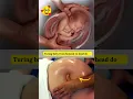 Download Lagu Turning Baby to Head Down Position 🥰 #shortvideo #ecv