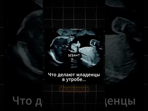 Что Делают Младенцы в Утробе🤰