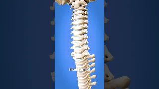 How To Spin Your Head Like An Owl 