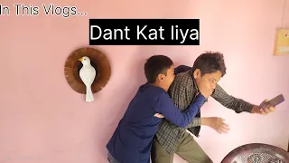 Khel me Dant Kat Liya 😁