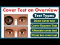 Cover Test an Overview