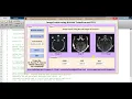 Matlab code for Image Fusion using Wavelet Transform and PCA