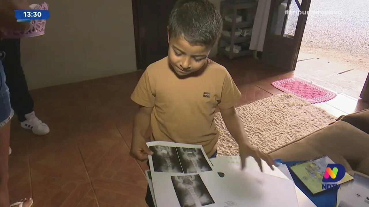 Esperança para Lucas: menino de 8 anos precisa de transplante de rim