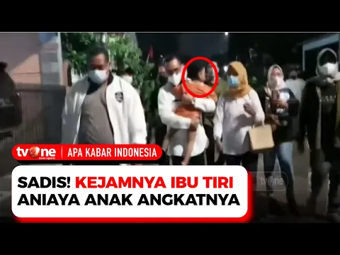 Sadis! Bocah Laki-Laki Dianiaya oleh Ibu Angkatnya Sampai Lebam