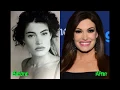Kimberly Guilfoyle Plastic Surgery Are the Rumors True