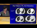 Download Lagu Thymic tumors and other thoracic zebras