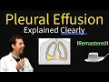 Pleural Effusions - Causes Diagnosis Symptoms Treatment