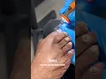 Download Lagu FUNGAL NAIL TRIM ON ELDERLY PATIENT🦶🏽 https://youtu.be/MpZOLRO30T0 #medicalpedicure #footcare