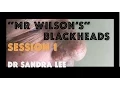Session 1 Mr Wilson Extracting large blackheads on the nose
