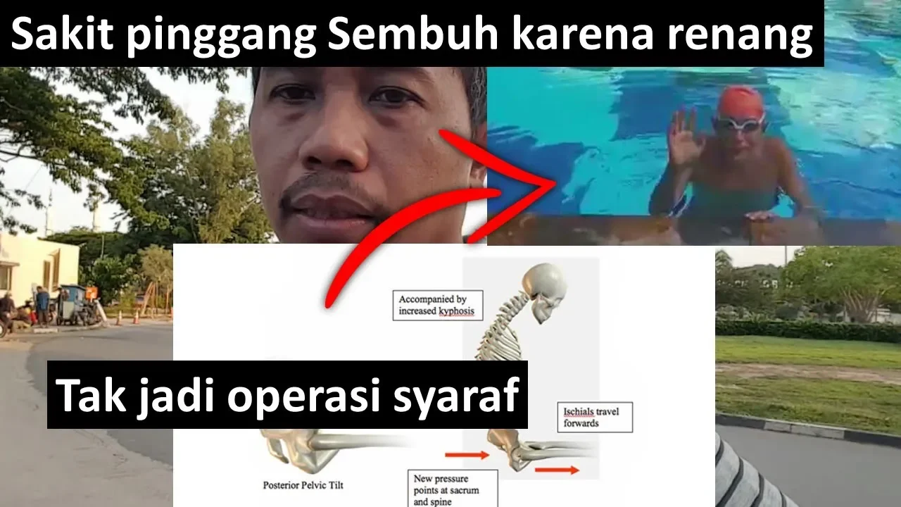 syaraf kejepit di tulang belakang akibat suka olahraga cardio dan sit up yang ga bener. kamu harus t. 