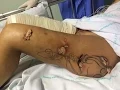 Download Lagu IMAGENS FORTES: Agência divulga fotos de Andressa Urach no hospital
