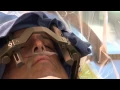 Download Lagu Deep Brain Stimulation Surgery to treat Parkinson's Disease at Mount Sinai Hospital