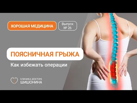 Поясничная грыжа / Как избежать операции / Рассказывает ведущий нейрохирург мира ?