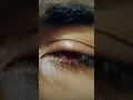 Download Lagu Sharingan Eyes Effect #naruto #shipudden  #sasuke #sharingan #uchihaclan #anime #aftereffects #vfx