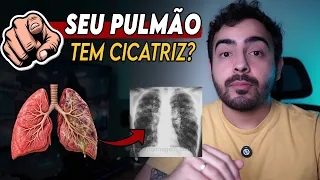 FIBROSE: a doença que transforma o pulmão! │ Médico Explica