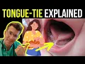 Download Lagu Doctor explains tongue tie in babies (ankyloglossia) - including treatment options!